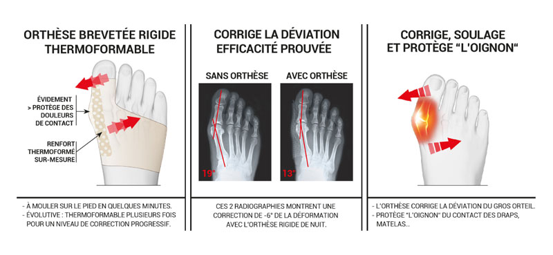 Orthese hallux valgus nuit epitact